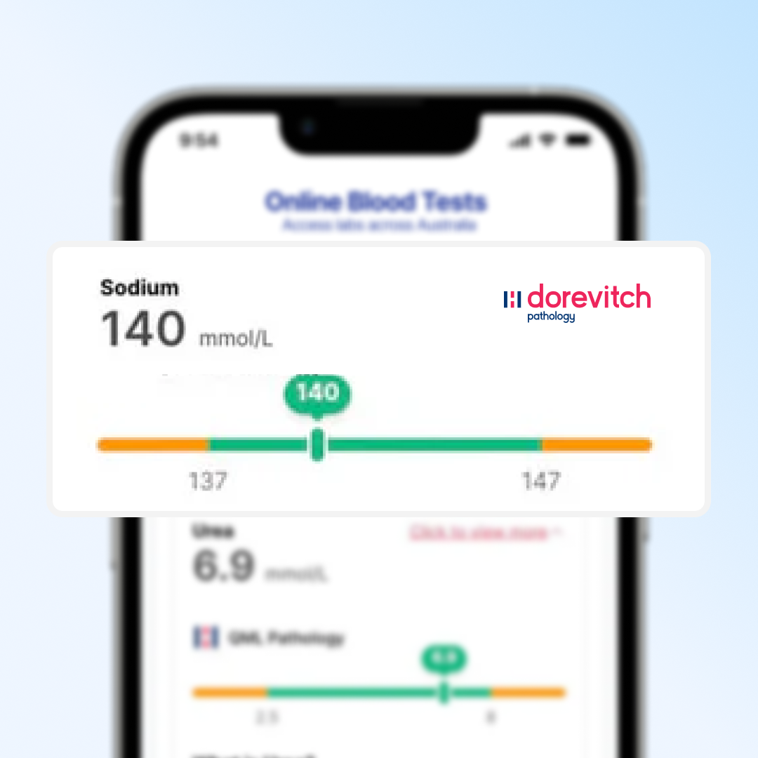Step 4 - View your blood test results online securely